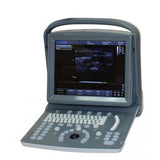 Echographe Chison ECO 1 sans batterie | sonde convexe (C3-A)